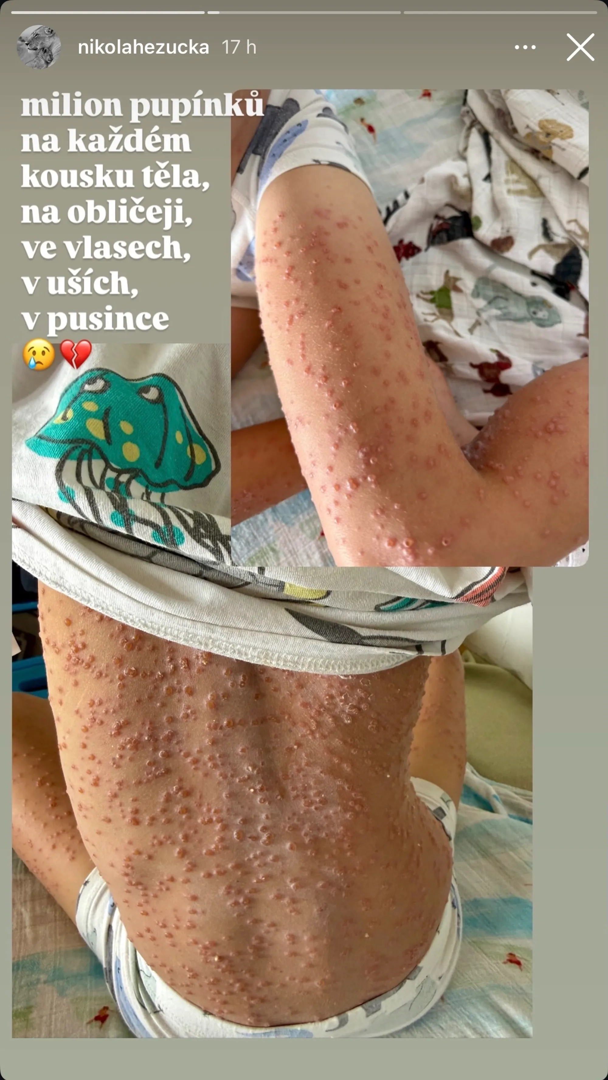 Bolest po smrti manžela ještě neskončila. Nikola Hezucká teď prožívá strach o syna.